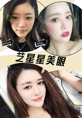 星粉美眼返图【曾繁茂院长】