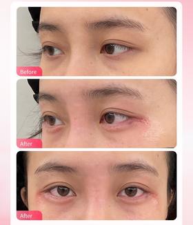 气质微整&恋恋桃花眼