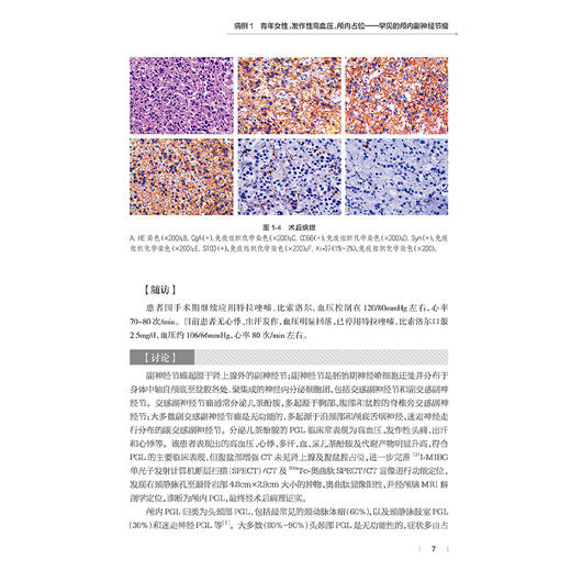 阜外高血压疑难病例解析 蔡军 张慧敏 主编 本书精选了临床诊疗中实际遇到的高血压疑难及特殊病例 9787117379991人民卫生出版社 商品图4