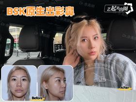 bsk原生出彩鼻返图【佘高明院长】