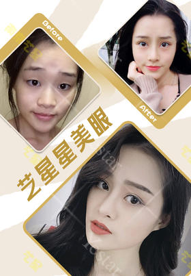 星粉反图美眼【曾繁茂院长】