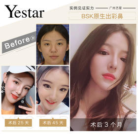 好评晒图鼻综合【佘高明院长】