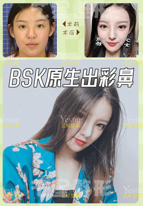 网红术后返图【佘高明院长】