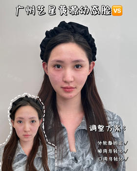 幼态脸完美打造【黄源主任】