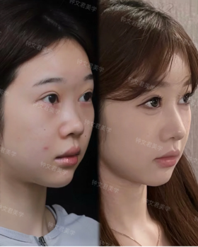 喜马拉雅中轴线【钟文君主任】