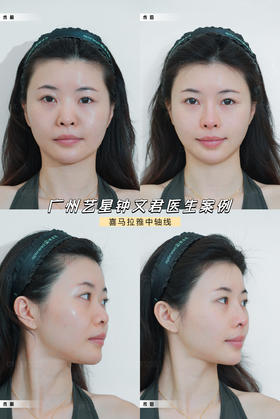 喜马拉雅中轴线案例【钟文君】