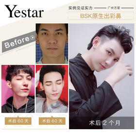 小鲜肉术后晒图【佘高明院长】