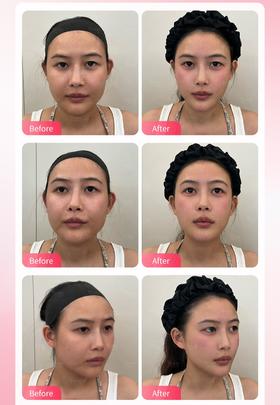 气质微整&防馒化美学