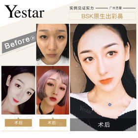 鼻综合美图【佘高明院长】