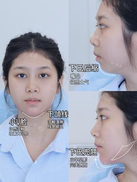 V脸男神改造【黄源主任】