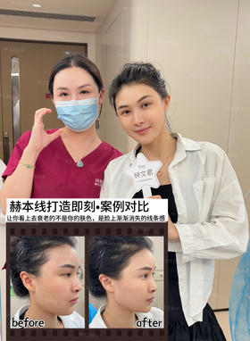 赫本线打造【钟文君主任】