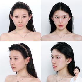 女神四宫美力图对比【王雯婷院长】