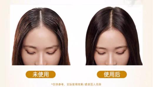 RYO黑吕臻参焕活御时昇机洗发水/护发素400ml 5大参养萃焕活头皮光泽提升润养 新老包装随机 商品图8