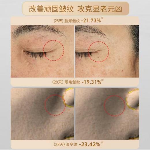 前100单拍2盒及以上赠唇霜一支（价值99元）！【容大生物 蕴能生肌紧肤盒/水光净透嫩肤盒 】独家专利 用类EGF活性肽-亟肤因 媲美超*光子 在家也能实现美美效果 商品图8