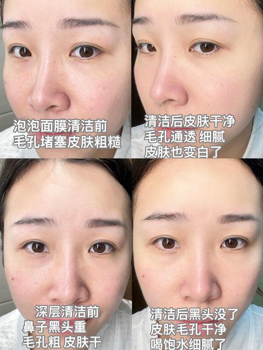 院线肌肤清洁面膜8重胶原进口专利泡泡面膜 商品图11