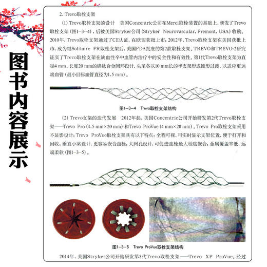 急性缺血性卒中再灌注治疗：血管内治疗操作规范 缪中荣 霍晓川 主译 急性缺血性卒中血管内治疗的基础等 科学技术文献出版社 商品图4