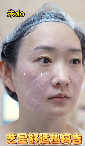 40+妈妈静享青春慢时光🕰 #艺星舒适热玛吉💡