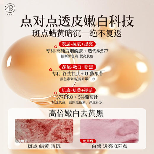 儒意奈皙美白祛斑修护霜50g 377美白祛斑面霜祛黄褐斑雀斑老年斑577淡化痘印去黄提亮|儒意官方商城 商品图3