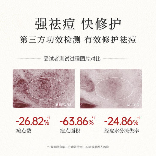 【99元任选3件】瑷露德玛芦荟鲜汁凝胶200g（特惠装） 补水  库拉索芦荟汁排成分首位 商品图2