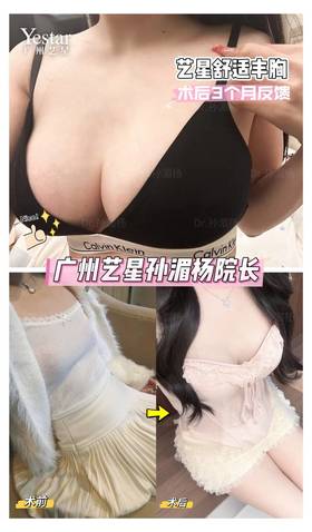 做过功课才敢丰胸📚 好机构➕好医生➕好技术