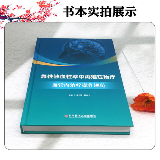 急性缺血性卒中再灌注治疗：血管内治疗操作规范 缪中荣 霍晓川 主译 急性缺血性卒中血管内治疗的基础等 科学技术文献出版社 商品图2