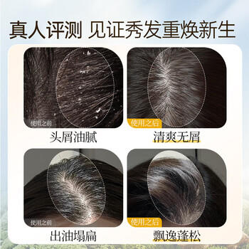 霸王生姜洗发水姜汁首乌去屑止痒洗发露洗头膏清新舒爽1L /个人护理 /洗发护发 /洗发水 商品图4