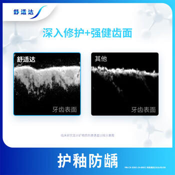 舒适达快速抗敏护理牙龈牙膏540g（180g*3+30g*2或牙刷）新旧包装随机发 /个人护理 /口腔护理 /牙膏 商品图0