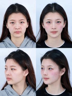 妈生感微调才是王道，素颜好自然