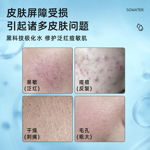 双极水修护舒缓液温和不刺激清爽舒缓褪红敏感肌补水保湿 商品图1