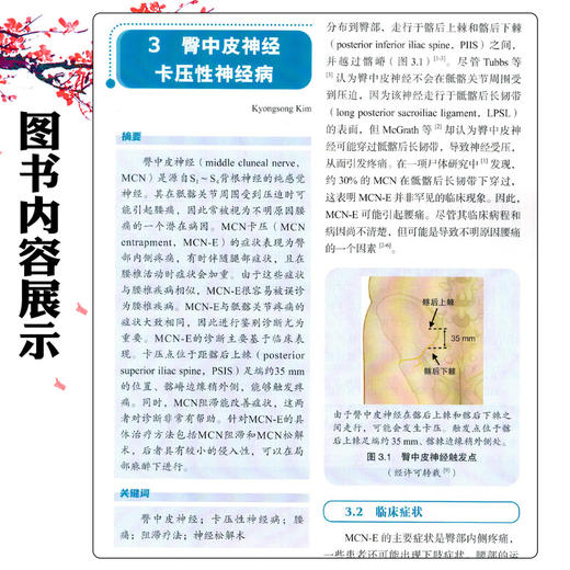 腰椎和下肢卡压性神经病 武百山 柳垂亮 李玉娟 程亮 主译 全面阐述了周围神经卡压的历史临床表现及诊治方法等科学技术文献出版社 商品图4