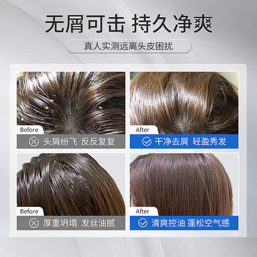 【清新清洁❗️二硫化硒去屑洗发露】无惧头屑头油，蓬松感、柔顺度好，清新洁净，呵护头发，抚平毛躁，外净柔顺抖音同款清爽控油抚平毛躁滋润洗发水育发 商品图2