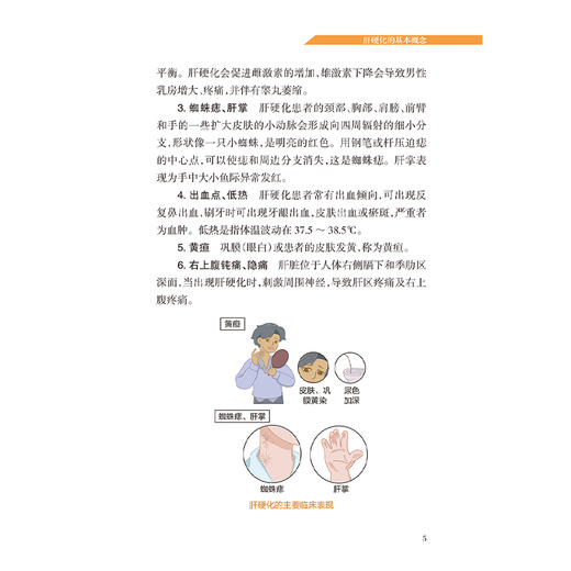 守护肝脏 了解肝硬化的真相 白飞虎 主编 详细介绍了肝硬化的病因临床表现发生发展检测方法治疗及注意事项等内容 人民卫生出版社 商品图4