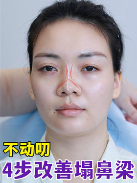 不叨叨告别塌鼻梁~注射打造0整感妈生鼻❗