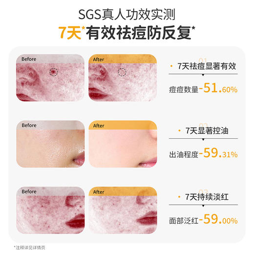 【祛痘3件套】7天控油祛痘 100%有效除螨 安肌控油祛痘护肤3件套（洁面+水+乳） 商品图3