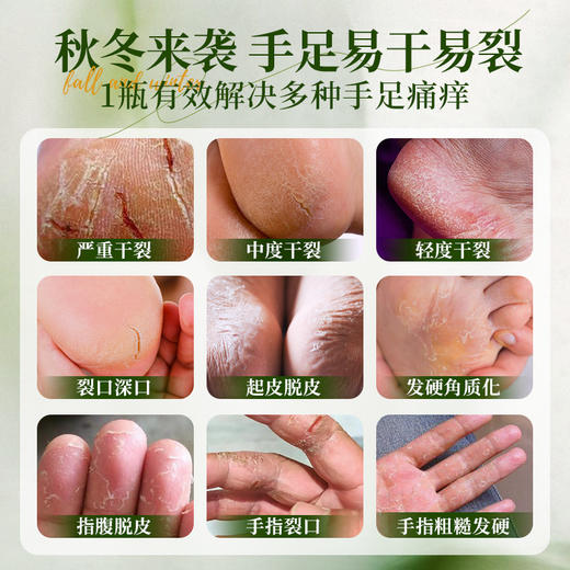 【防裂】【秋冬滋润霜】南非Clere小绿膏~脚后跟防裂，非洲香樟+葵花籽油+羊毛脂，三重抗裂，驱蚊、滋润、修复、开裂、倒刺、起皮、皮屑这一瓶就够了 商品图5