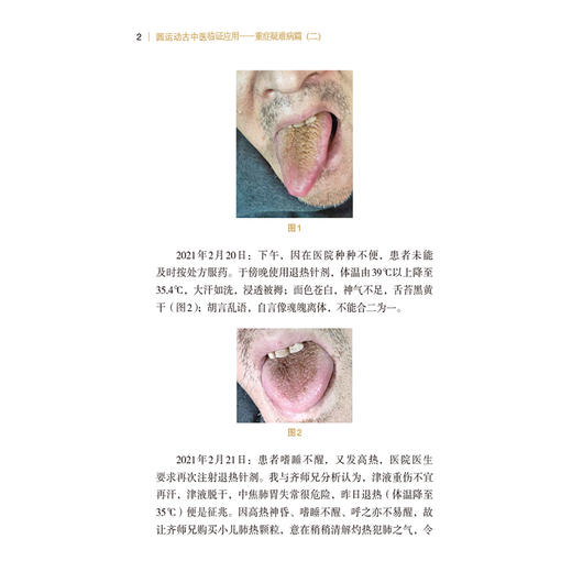 圆运动古中医临证应用 重症疑难病篇（二） 图解圆运动古中医临床应用丛书 张芳珍 张涵 主编 9787521440973中国医药科技出版社 商品图4