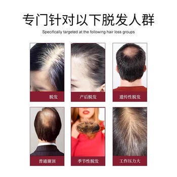 同仁堂生姜洗发水防脱育发洗发水脱发固发控油草本老姜王400ml*1+泵头*1 /个人护理 /洗发护发 /洗发水 商品图7