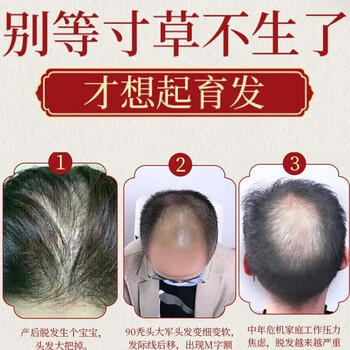 同仁堂生姜洗发水防脱育发洗发水脱发固发控油草本老姜王400ml*1+泵头*1 /个人护理 /洗发护发 /洗发水 商品图2