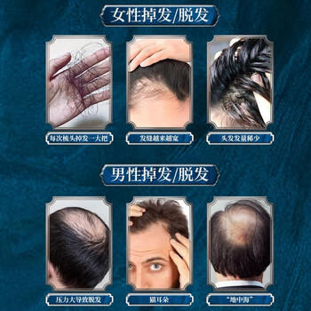 同仁堂生姜洗发水防脱育发洗发水脱发固发控油草本老姜王400ml*1+泵头*1 /个人护理 /洗发护发 /洗发水 商品图6