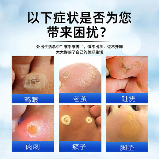 【19.9得12贴❗鸡尤康贴】只需贴一贴深入渗透，软化温和，足部护理去鸡眼膏老茧死皮肉刺草本鸡眼贴QQ 商品图1