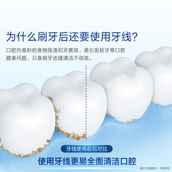 欧乐B后牙清洁Y型牙线棒便携牙线棒牙签细滑线30支*3新老包装混发 /个人护理 /口腔护理 /牙线/牙线棒 商品图2