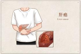 秋季是“养肝黄金期”，很多人白白浪费！把握好了，肝比同龄人年轻十岁