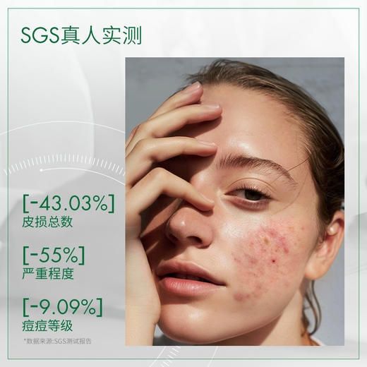 【郑州仓】西班牙BIRETIX 祛痘小绿盖精华乳Duo30ml/瓶 赠抗痘洁面10ml*5 商品图2