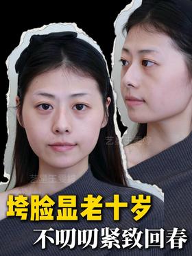 垮脸显老十岁？中下面部松弛自救指南