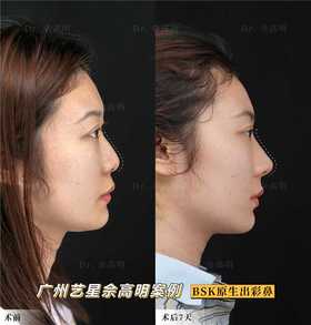 1V1量身定制☑ 0整感的妈生鼻👃🏻