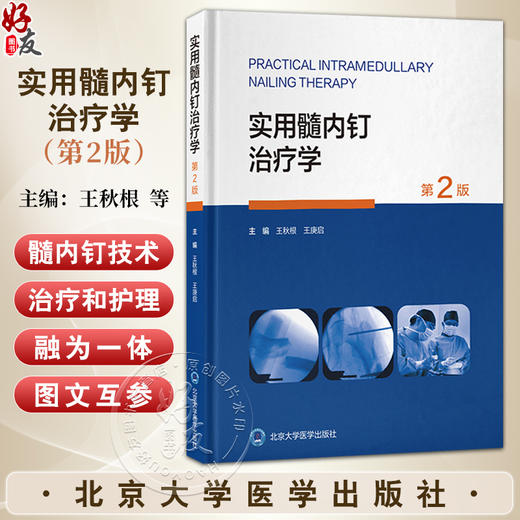 实用髓内钉治疗学 第2二版 王秋根 王庚启 主编 详细介绍四肢长骨如肱骨 股骨和腓骨骨折的髓内钉治疗等 北京大学医学出版社 商品图0