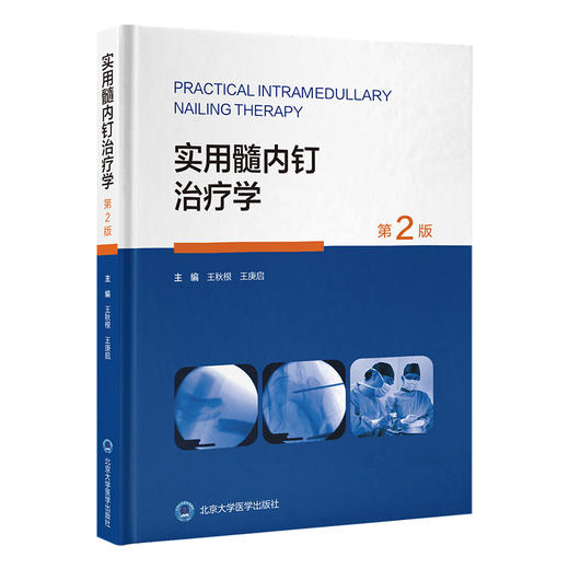 实用髓内钉治疗学 第2二版 王秋根 王庚启 主编 详细介绍四肢长骨如肱骨 股骨和腓骨骨折的髓内钉治疗等 北京大学医学出版社 商品图1