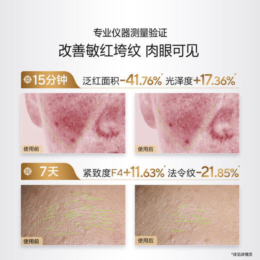 【小金管抗老套组】30岁+姐妹必入，拯救熬夜垮脸-细纹-暗沉-泛红-高效补胶原 商品图2