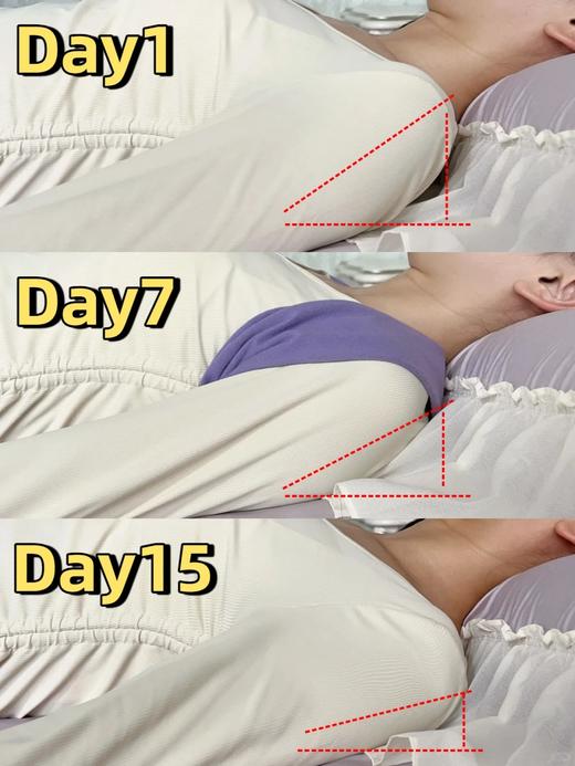 🔥睡姿开挂 肩不内扣‼️【出口日本睡眠开肩矫姿带】睡对了，真的会变美💕 商品图6