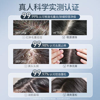 韩方五谷毛囊炎洗发水去屑止痒马拉色菌控油蓬松洗头膏露男女500ml /个人护理 /洗发护发 /洗发水 商品图1